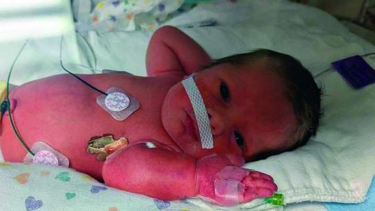 Piedmont Family Welcomed Baby Boy At 31-Weeks