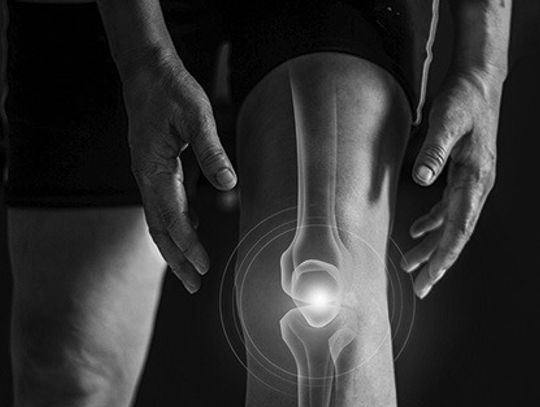 How Arthritis Affects Daily Life And Mobility
