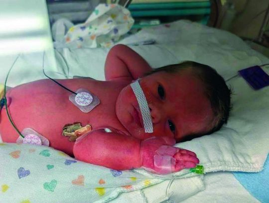 Piedmont Family Welcomed Baby Boy At 31-Weeks