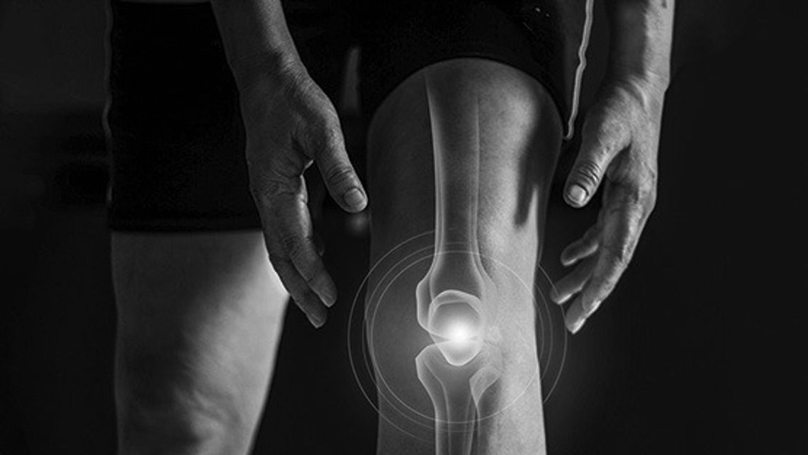 How Arthritis Affects Daily Life And Mobility
