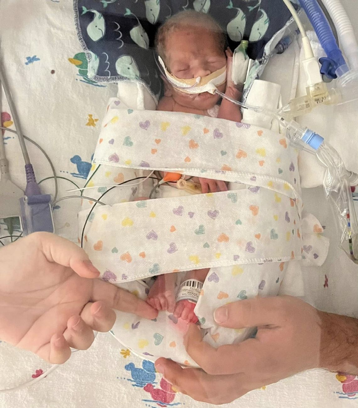 Monterrey Dinner Fundraiser To Be Held This Wednesday To Assist Schulte Family