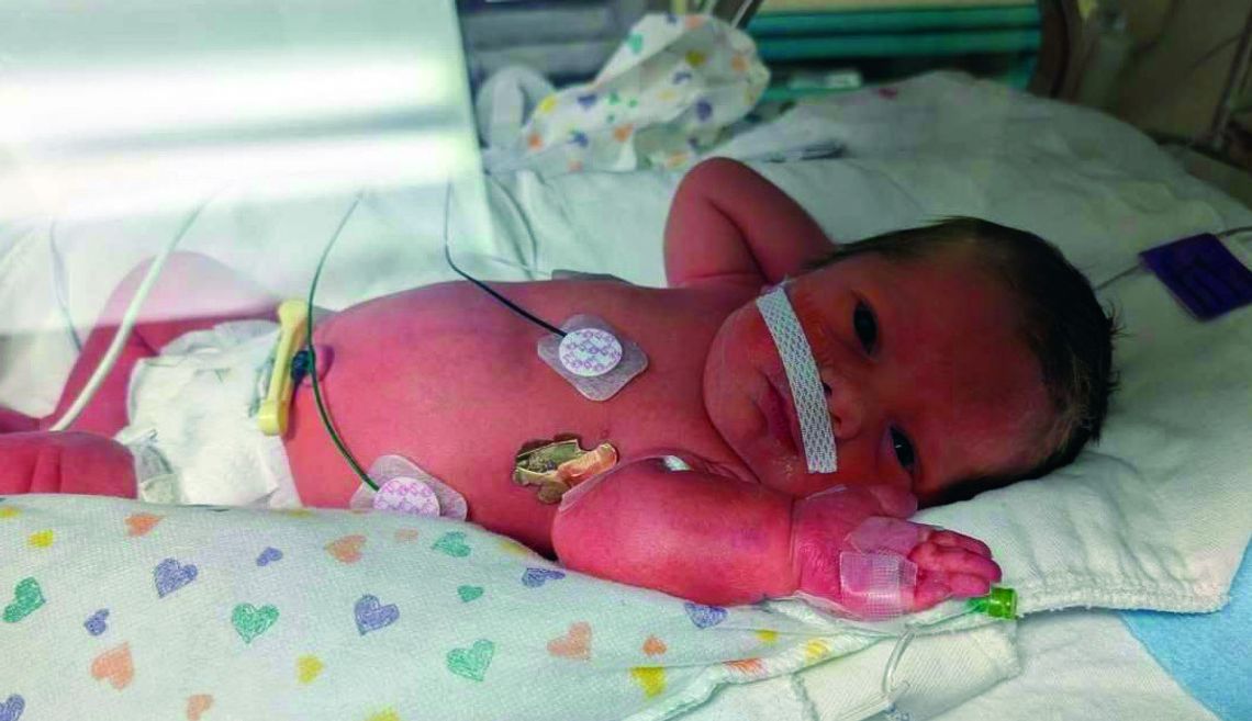 Piedmont Family Welcomed Baby Boy At 31-Weeks